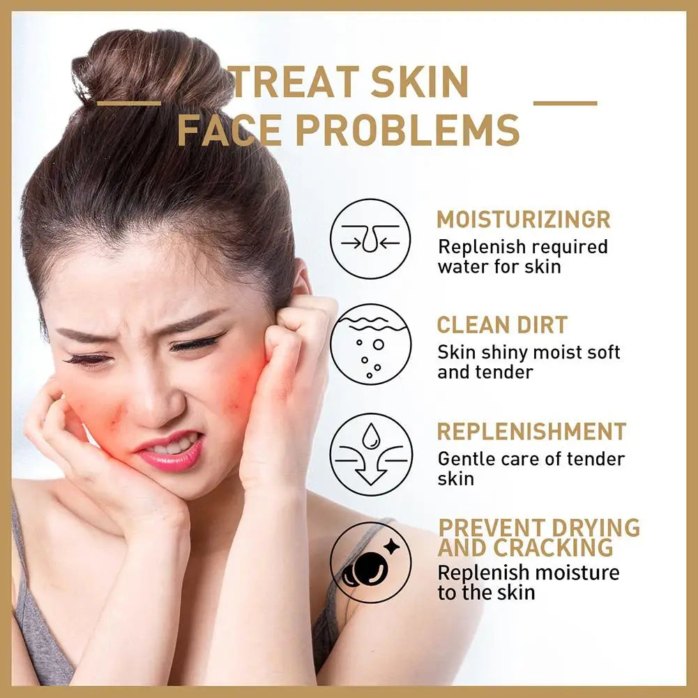 Rice Face Toner Anti-Aging Moisturizing Water Dark Spot Acne Remover 150Ml Deep Facial Cleanser for Young Glowy Korean Skin Care