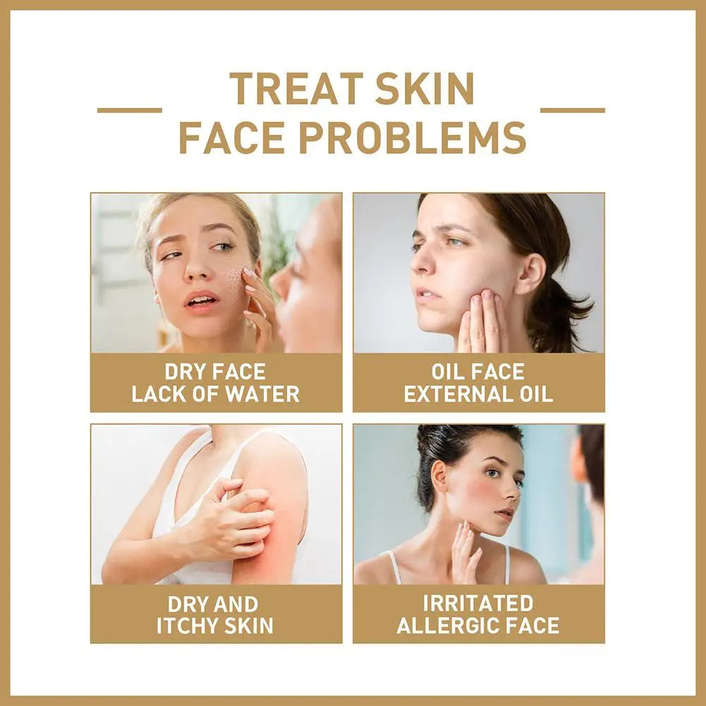 Rice Face Toner Anti-Aging Moisturizing Water Dark Spot Acne Remover 150Ml Deep Facial Cleanser for Young Glowy Korean Skin Care