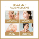 Rice Face Toner Anti-Aging Moisturizing Water Dark Spot Acne Remover 150Ml Deep Facial Cleanser for Young Glowy Korean Skin Care